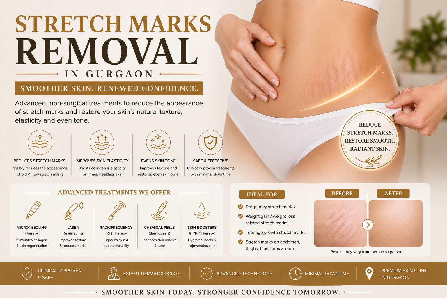 Stretch marks treatment consultation at Avenza in Gurgaon