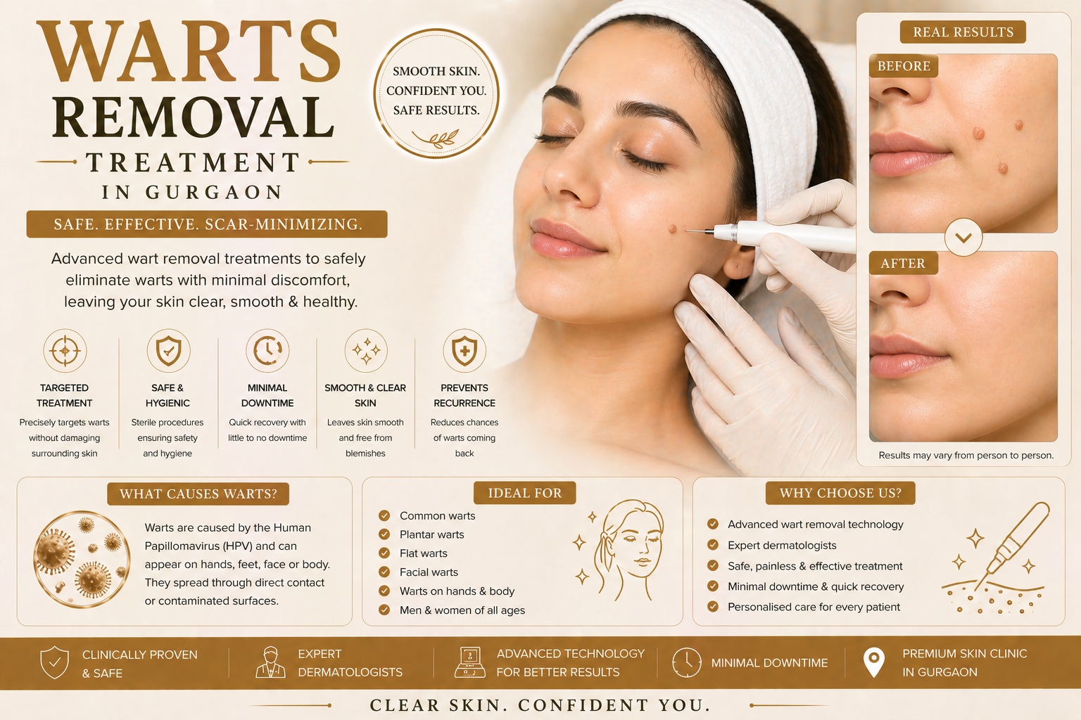 Wart removal treatment consultation at Avenza in Gurgaon