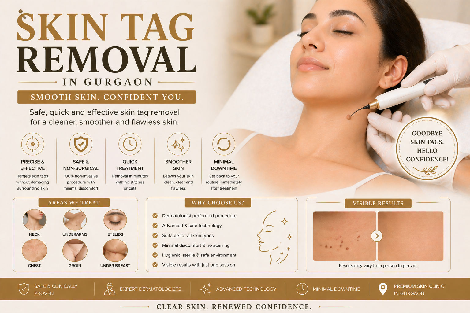 Skin tag removal consultation at Avenza in Gurgaon
