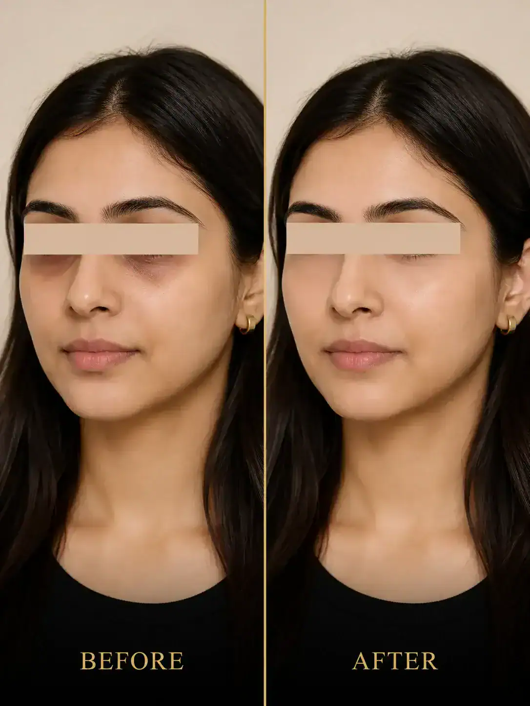 Dark Circle Care before and after result