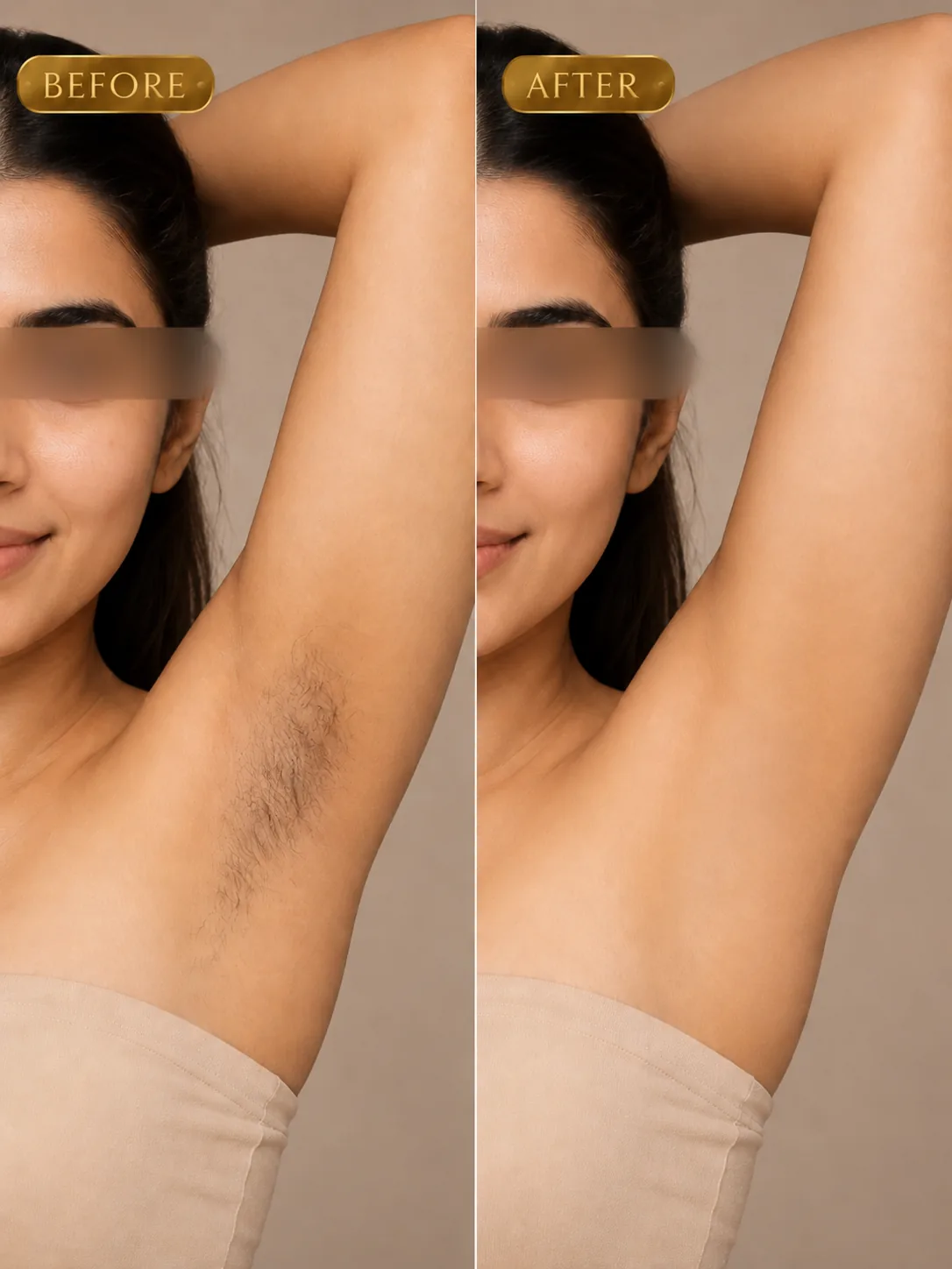 Laser Hair Reduction before and after result