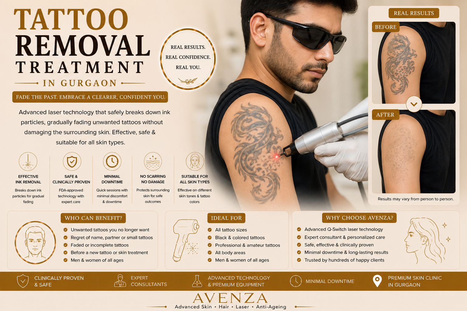 Laser tattoo removal consultation at Avenza in Gurgaon